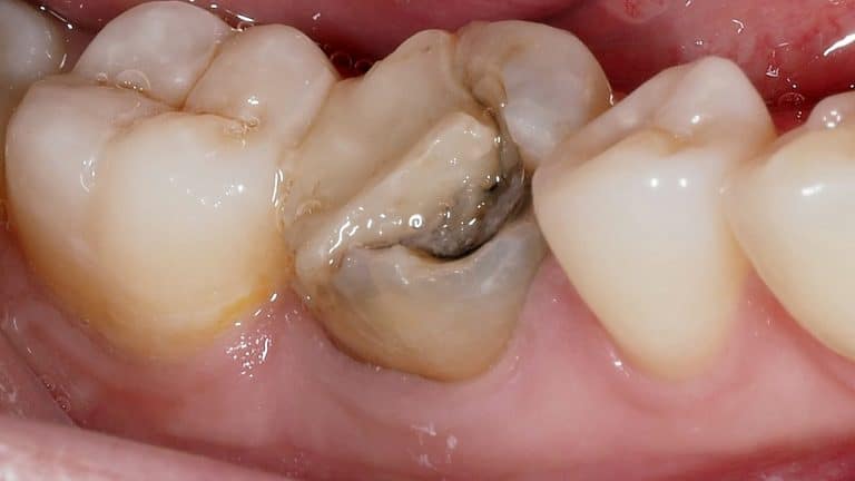 Pre-surgical